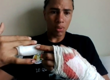 Advogado baleado por Guarda Civil de Curitiba diz que foi alvo de represália