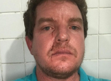Diretor da FUP é agredido por apoiador de Bolsonaro