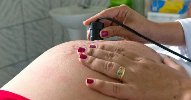 Risco de morte materna cai até 31% entre quem recebe o Bolsa Família – CUT